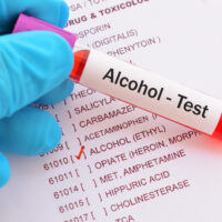 BloodSampleWithRequisitionFormForAlcoholTest